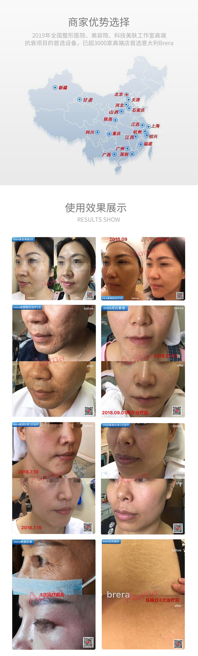 博瑞莱仪器 铂瑞莱仪器美容价格 澳玛 提拉抗皱黄金点阵设备工厂_50aa82b3.jpg